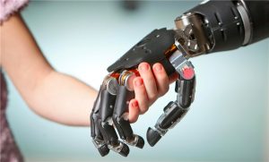 3d printed prosthetic hands